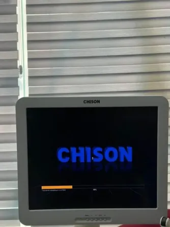 УЗИ CHISON I3 Стационар аппарат Ходжейли